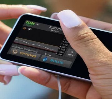 پمپ انسولین هوشمند