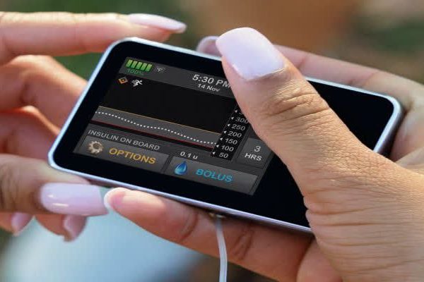 پمپ انسولین هوشمند