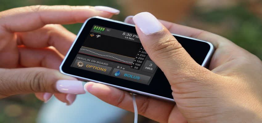 پمپ انسولین هوشمند